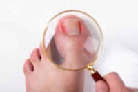 Causes and Risk Factors of Ingrown Toenails